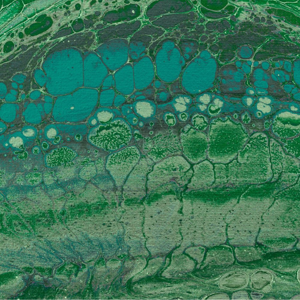 Red blood cell omega-3 fatty acid levels and markers of accelerated brain aging