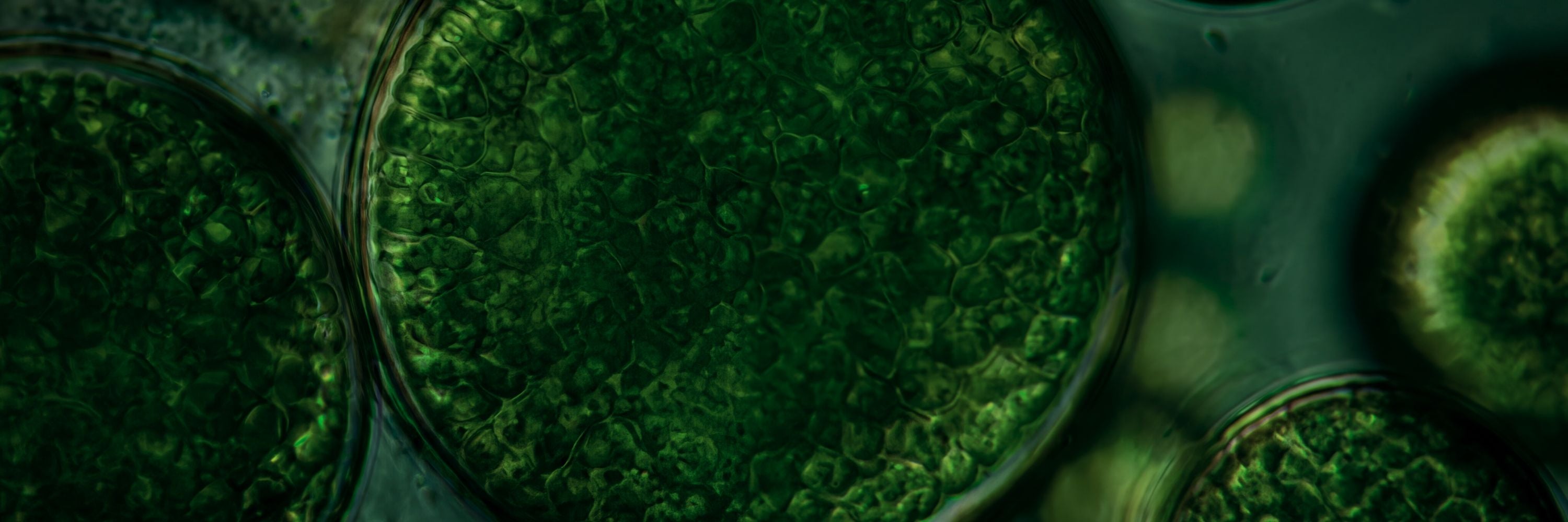 Close-up of green algae under a microscope